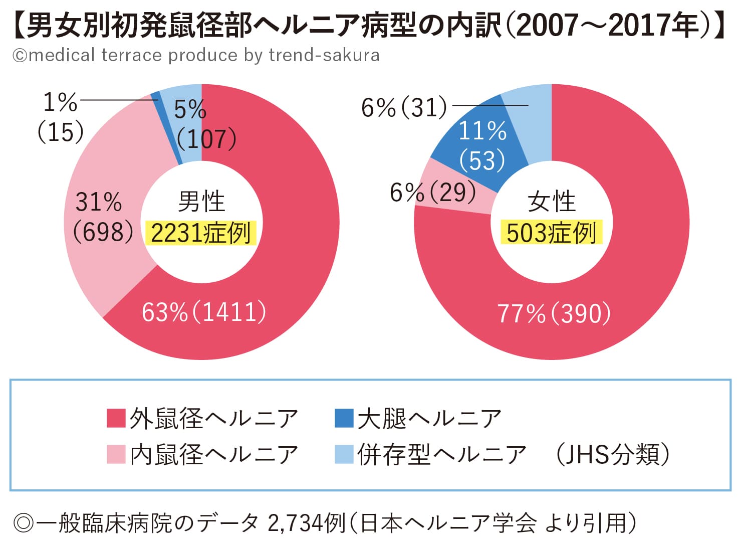 男女別初発鼠径部ヘルニア病型の内訳（2007〜2017年）