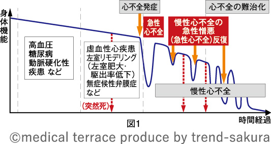 【心不全とそのリスクの進展ステージ】