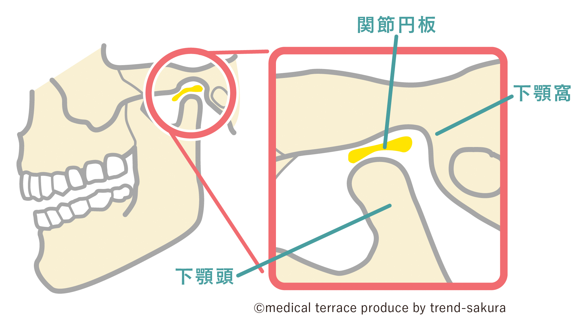 顎関節症は4つのタイプに分類されます。