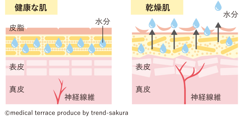 健康な肌と乾燥肌