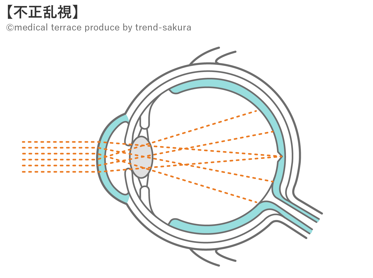 眼球断面図と組織の役割